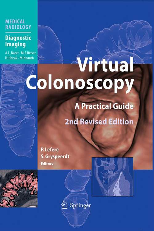 Book cover of Virtual Colonoscopy