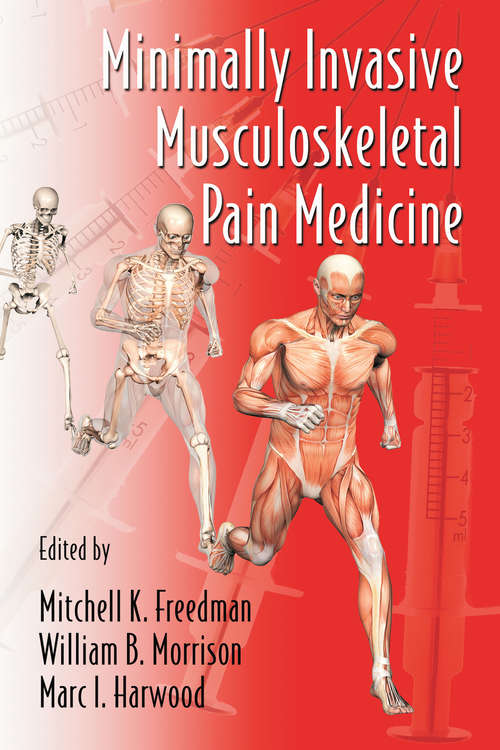 Book cover of Minimally Invasive Musculoskeletal Pain Medicine (Minimally Invasive Procedures in Orthopaedic Surgery)