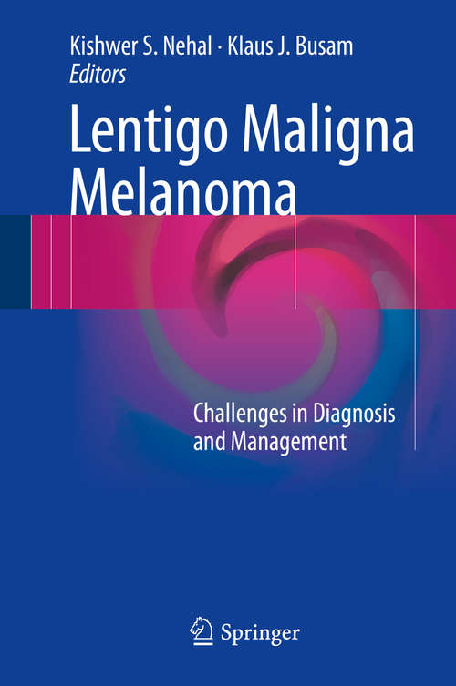 Book cover of Lentigo Maligna Melanoma