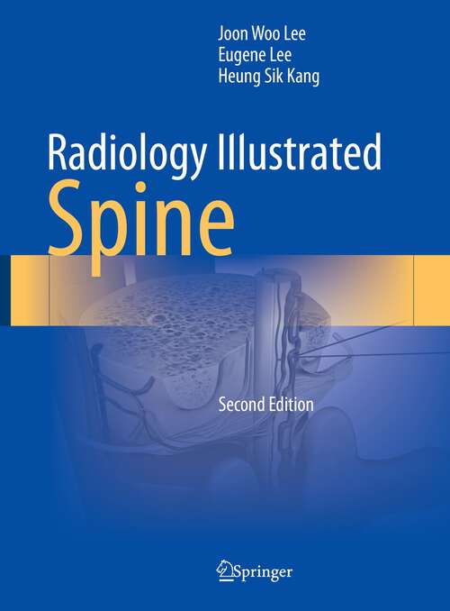 Book cover of Radiology Illustrated: Spine (2nd ed. 2023) (Radiology Illustrated)