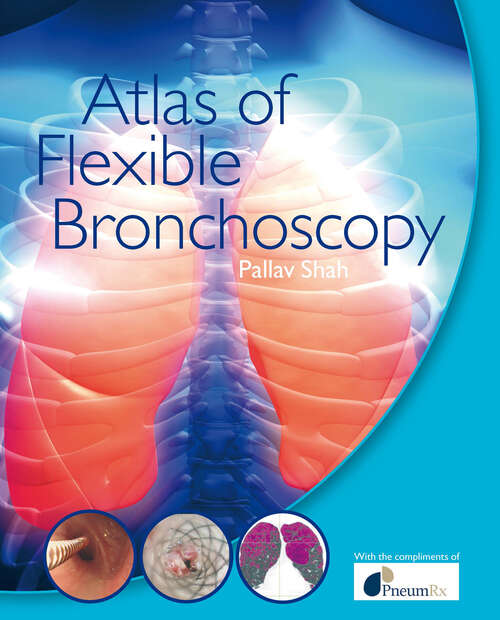 Book cover of Atlas of Flexible Bronchoscopy