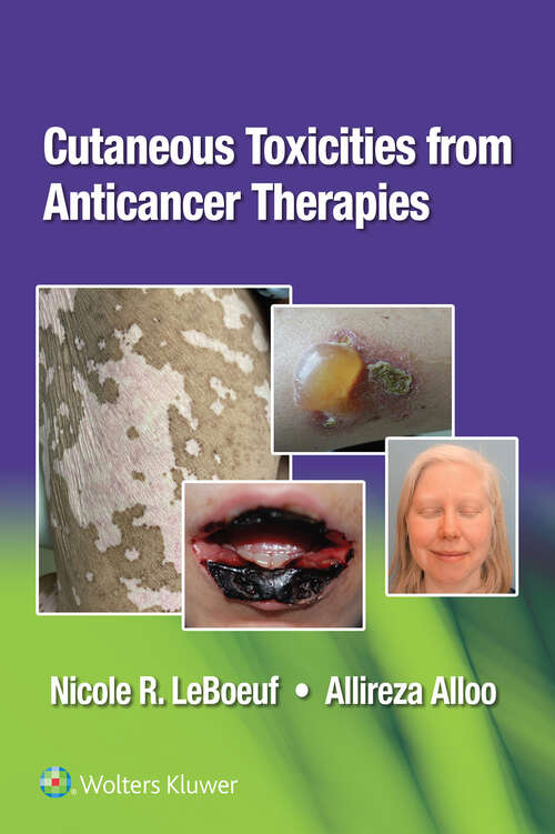 Book cover of Cutaneous Reactions from Anti-Cancer Therapies