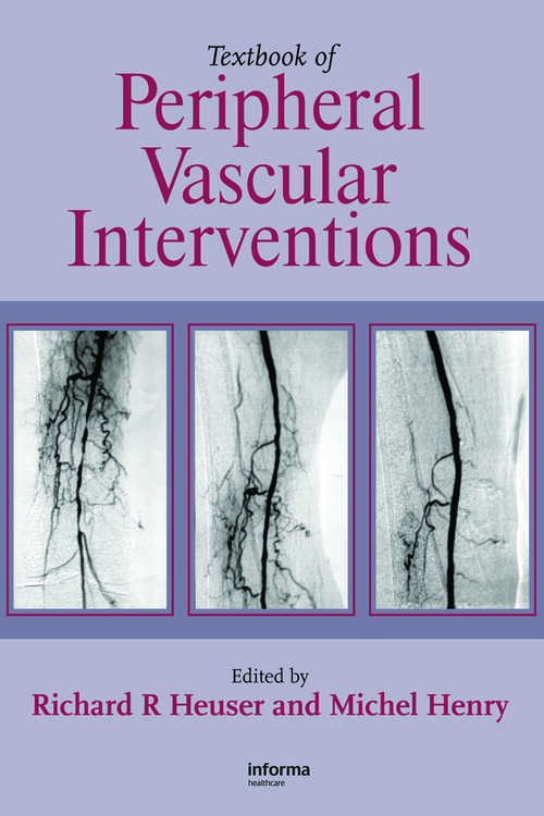 Book cover of Textbook of Peripheral Vascular Interventions (2)