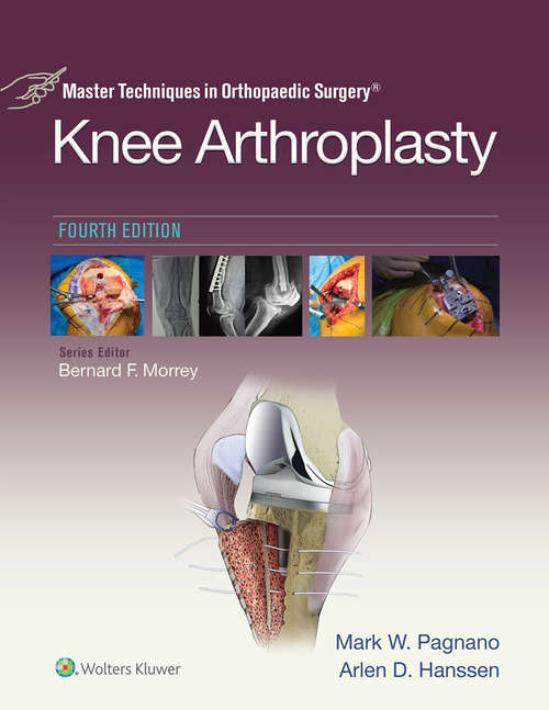 Book cover of Master Techniques in Orthopedic Surgery: Knee Arthroplasty (4) (Master Techniques in Orthopaedic Surgery)