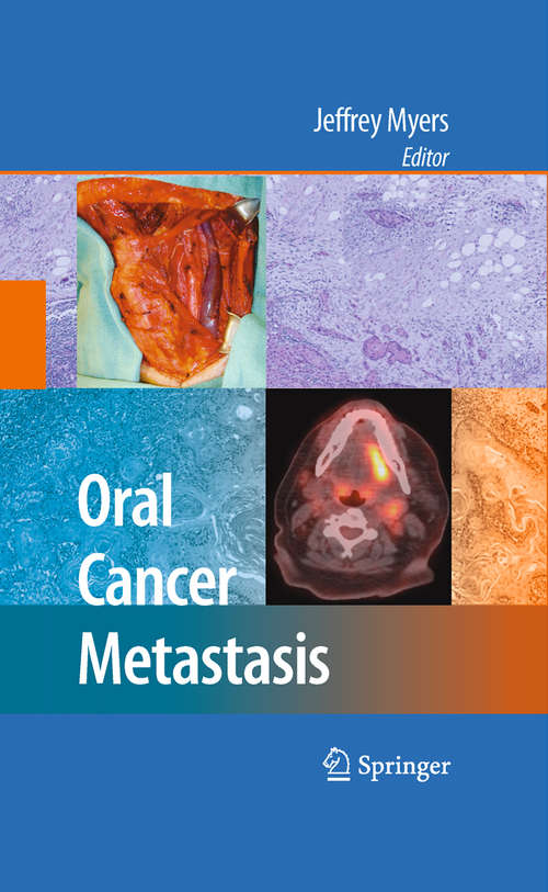 Book cover of Oral Cancer Metastasis