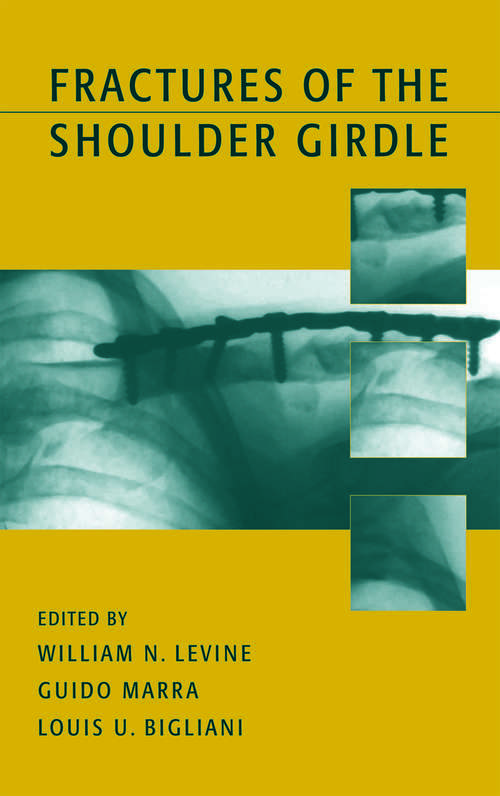 Book cover of Fractures of the Shoulder Girdle