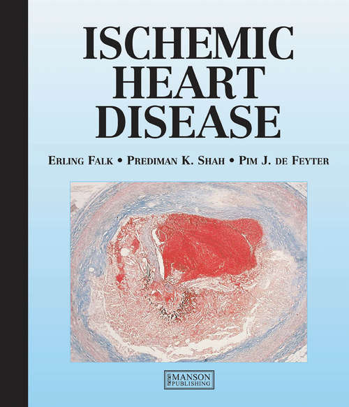 Book cover of Ischemic Heart Disease