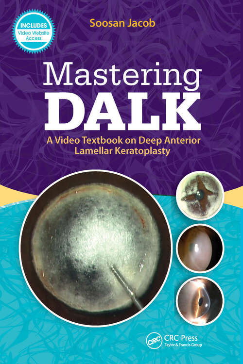 Book cover of Mastering DALK: A Video Textbook on Deep Anterior Lamellar Keratoplasty