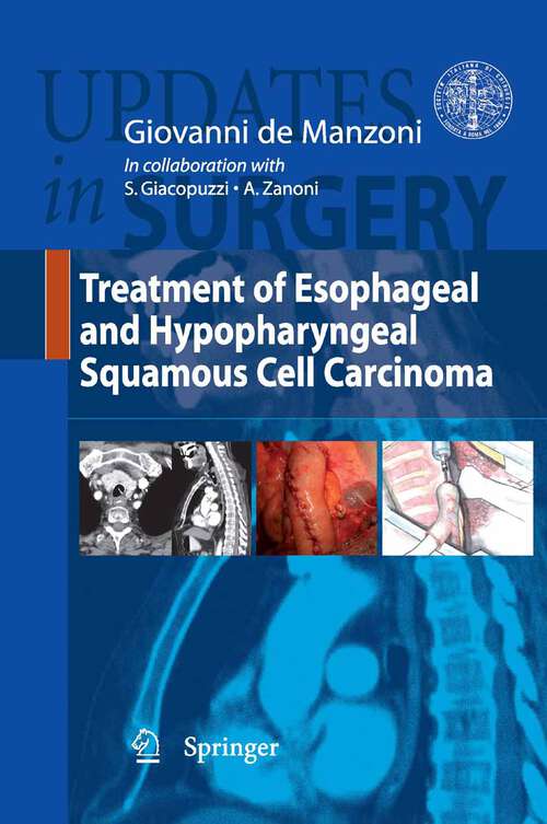 Book cover of Treatment of Esophageal and Hypopharingeal Squamous Cell Carcinoma