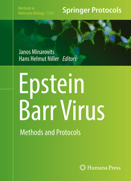 Book cover of Epstein Barr Virus