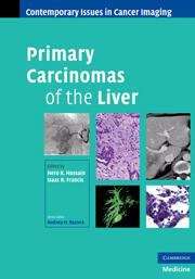 Book cover of Primary Carcinomas of the Liver