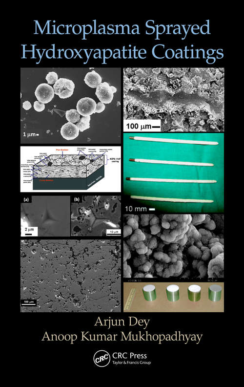 Book cover of Microplasma Sprayed Hydroxyapatite Coatings