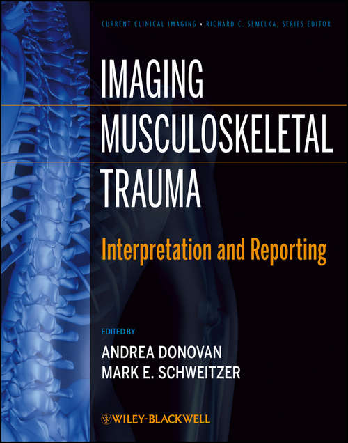 Book cover of Imaging Musculoskeletal Trauma