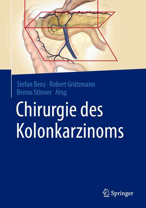 Book cover of Chirurgie des Kolonkarzinoms (1. Aufl. 2021)