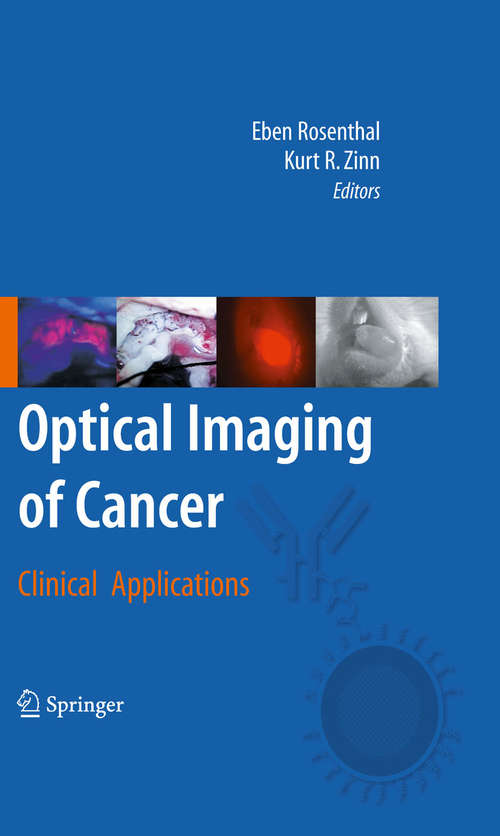 Book cover of Optical Imaging of Cancer