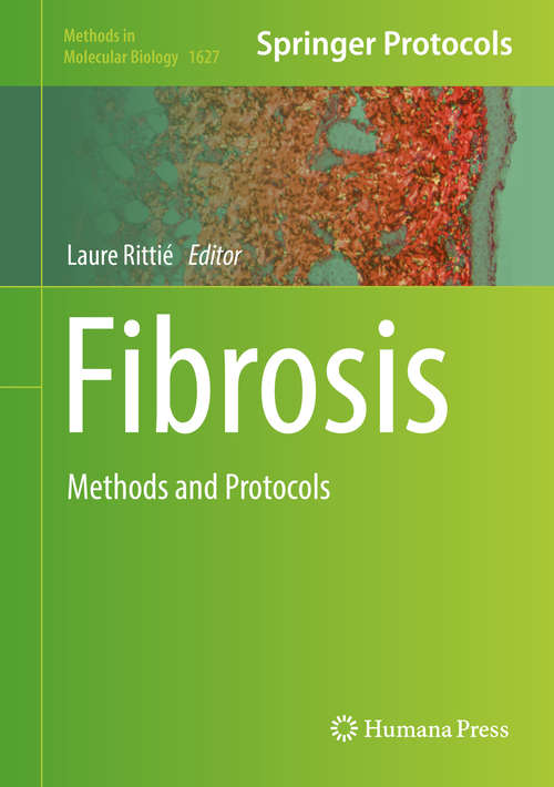 Book cover of Fibrosis: Methods and Protocols (1st ed. 2017) (Methods in Molecular Biology #1627)