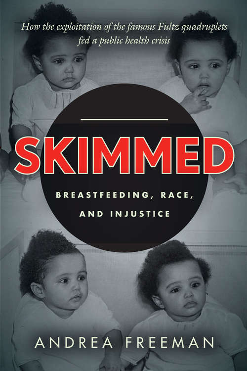 Book cover of Skimmed: Breastfeeding, Race, and Injustice