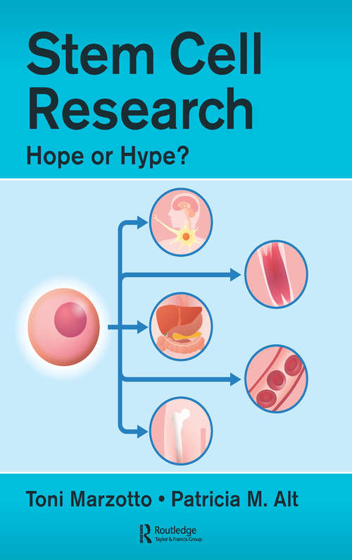 Book cover of Stem Cell Research: Hope or Hype?