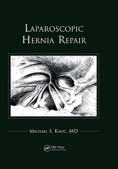 Book cover of Laparoscopic Hernia Repair