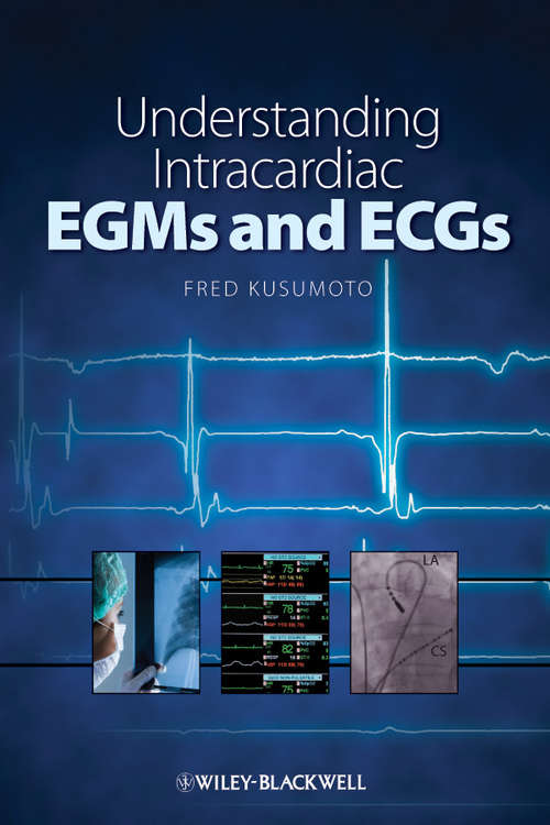 Book cover of Understanding Intracardiac EGMs and ECGs