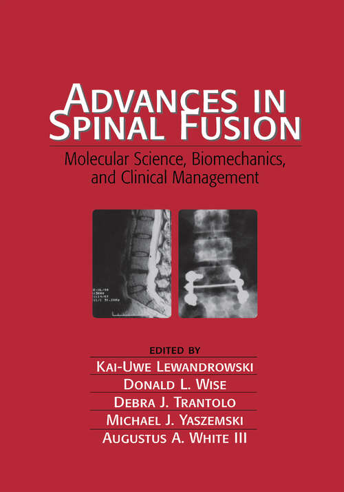 Book cover of Advances in Spinal Fusion: Molecular Science, BioMechanics, and Clinical Management (1)