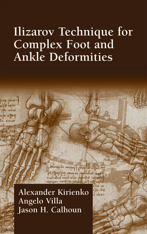 Book cover of Ilizarov Technique for Complex Foot and Ankle Deformities (1)