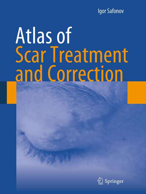 Book cover of Atlas of Scar Treatment and Correction