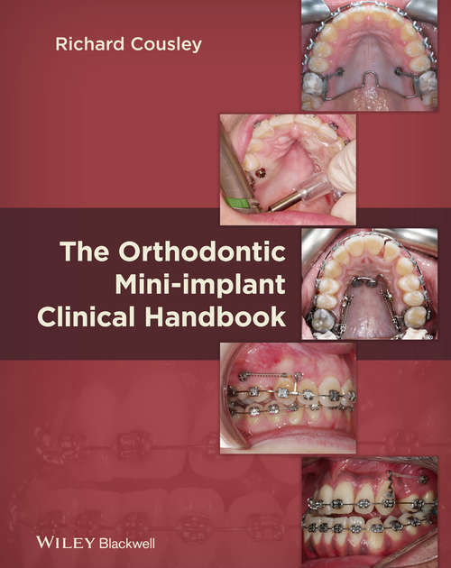 Book cover of The Orthodontic Mini-implant Clinical Handbook