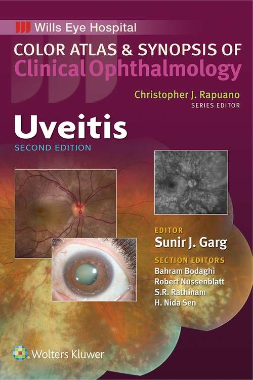 Book cover of Uveitis (2) (Color Atlas and Synopsis of Clinical Ophthalmology)