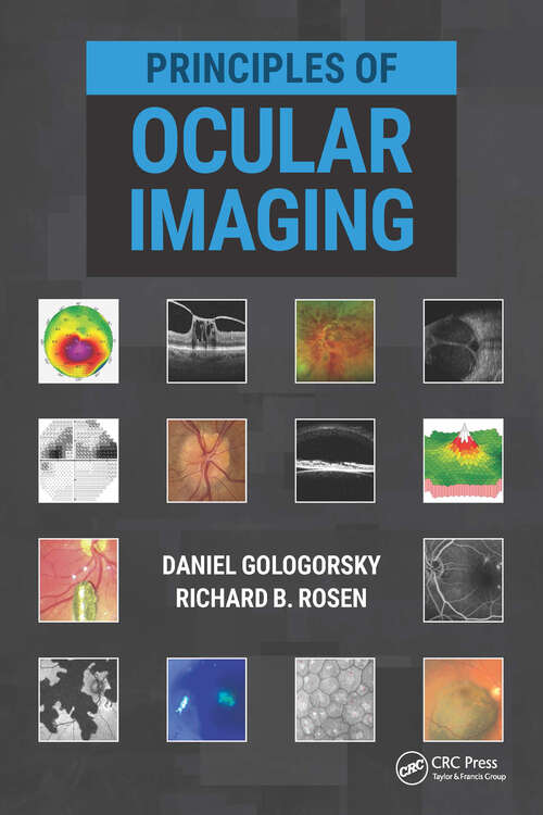 Book cover of Principles of Ocular Imaging