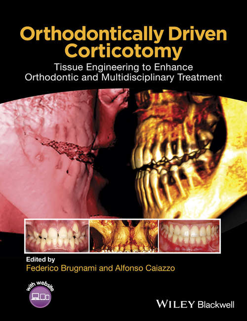 Book cover of Orthodontically Driven Corticotomy