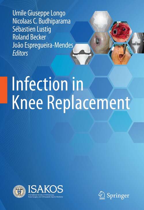 Book cover of Infection in Knee Replacement (1st ed. 2022)